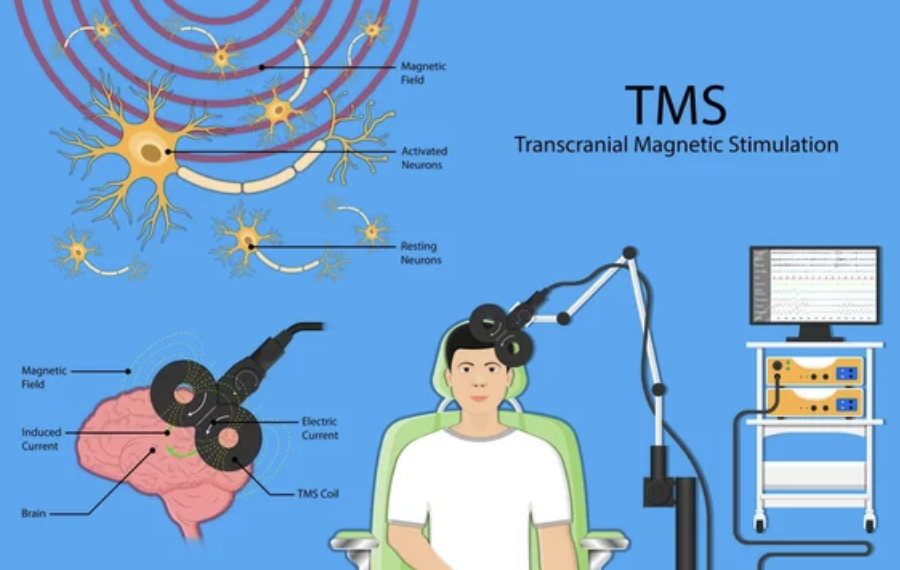 Estimulación Magnética Transcraneal (EMT) en Autismo