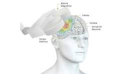 La Estimulación Magnética Transcraneal (EMT) y ACV